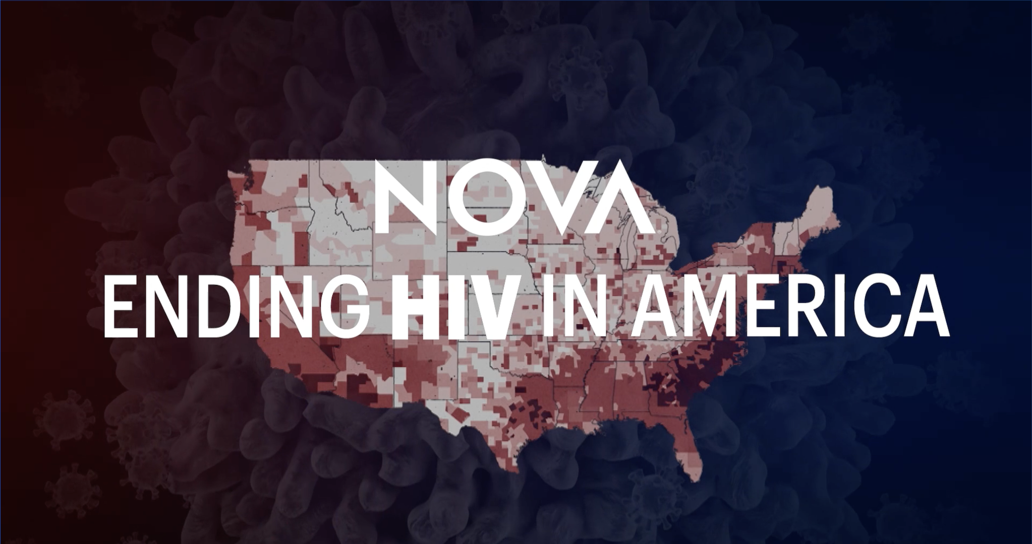 Ending HIV in America