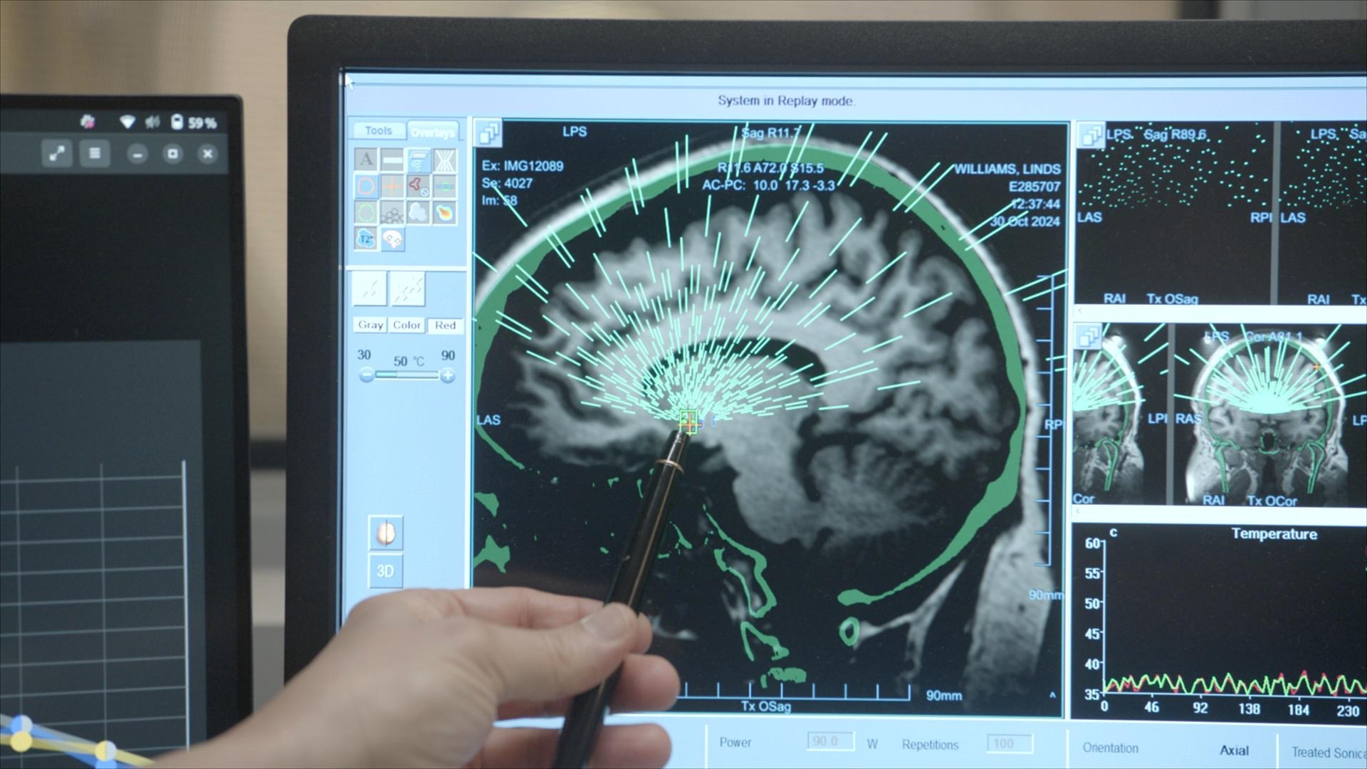 Mindshift: Rewiring the Human Brain <br/>RESOLVE TO SOLVE WITH MILES O’BRIEN